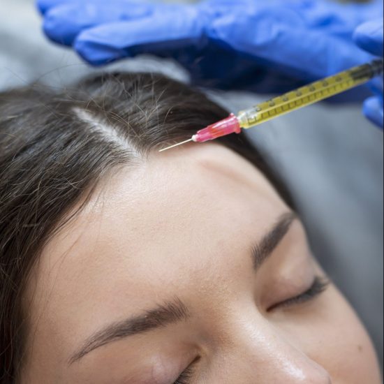 close-up-young-woman-getting-prp-injection